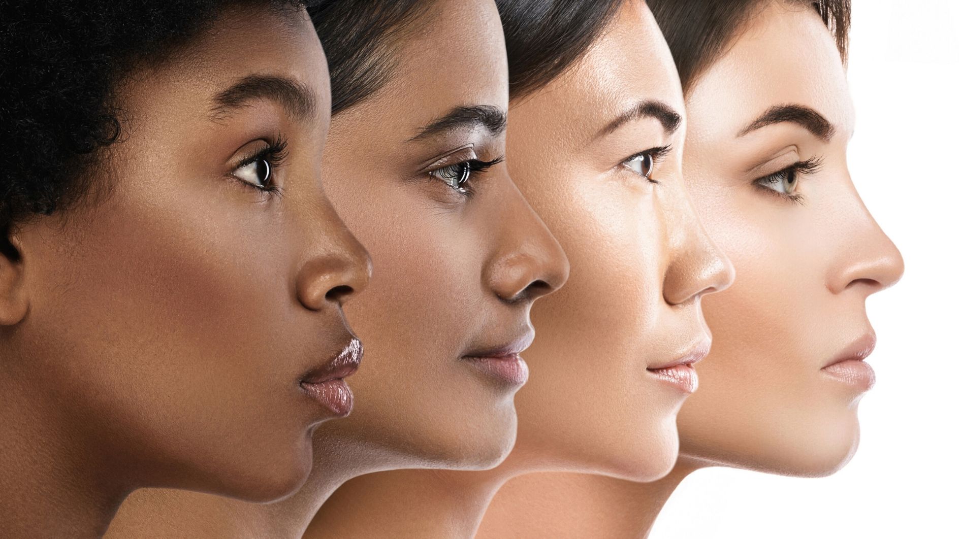 laser pigmentation removal for dark skin