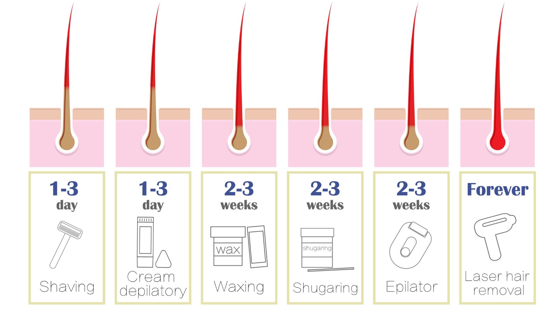 laser hair remvoal v epilation