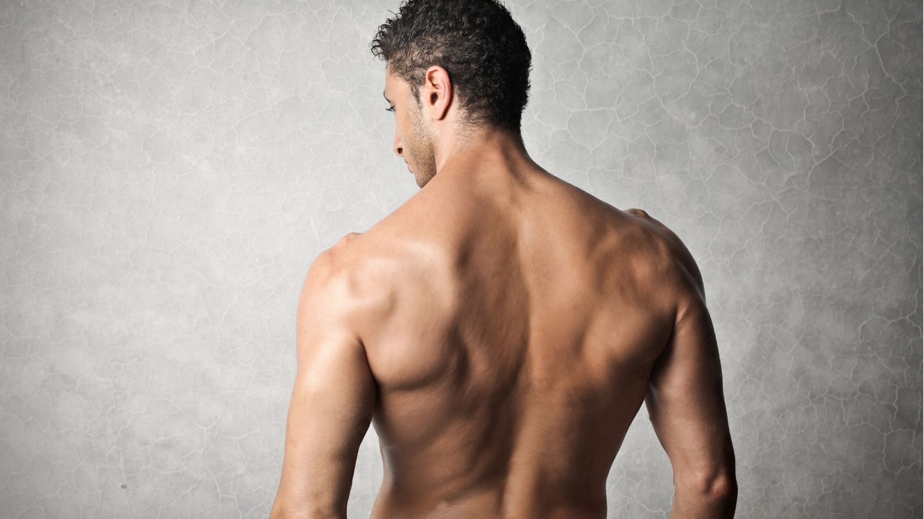 stretch mark removal for men