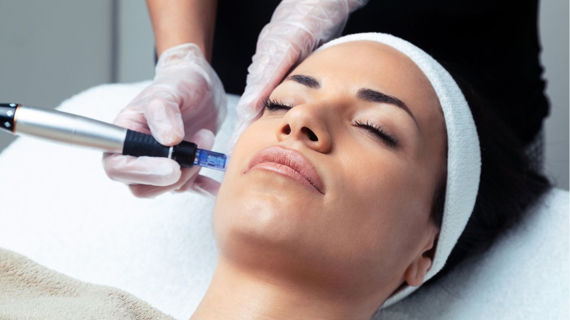 microneedling with a dermapen