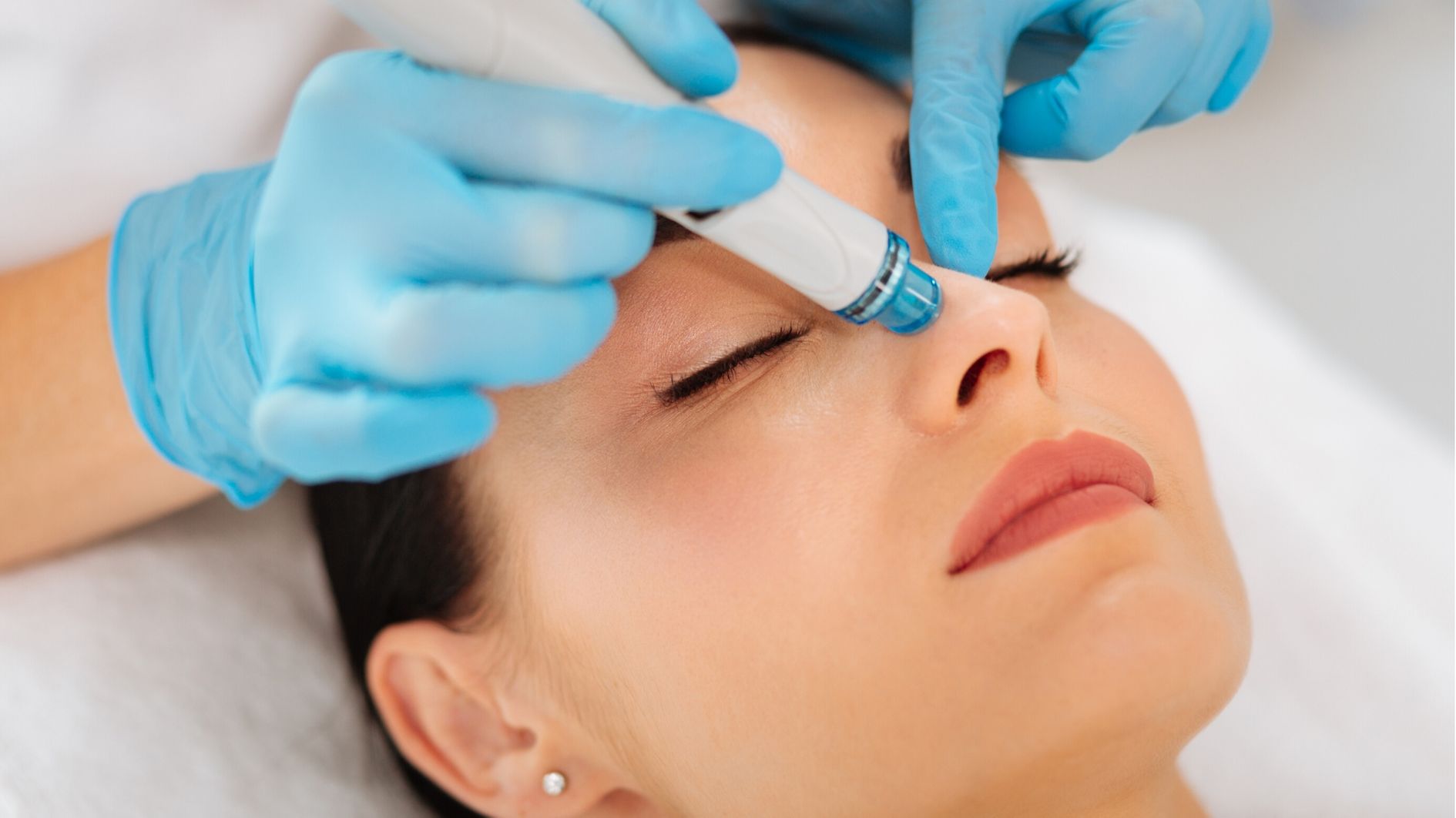 hydrafacial side effects