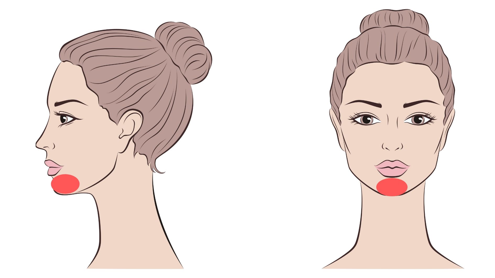 facial laser hair removal chin treatment area