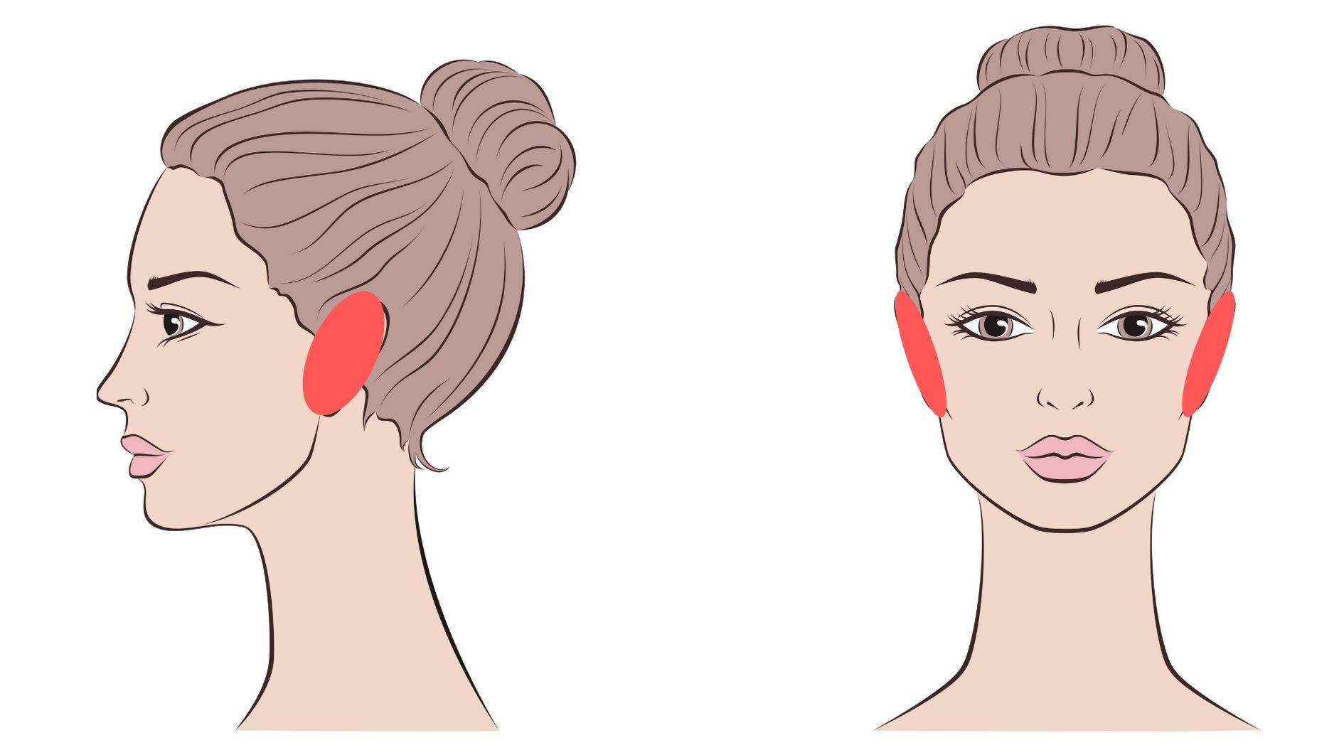facial laser hair removal earsl treatment area