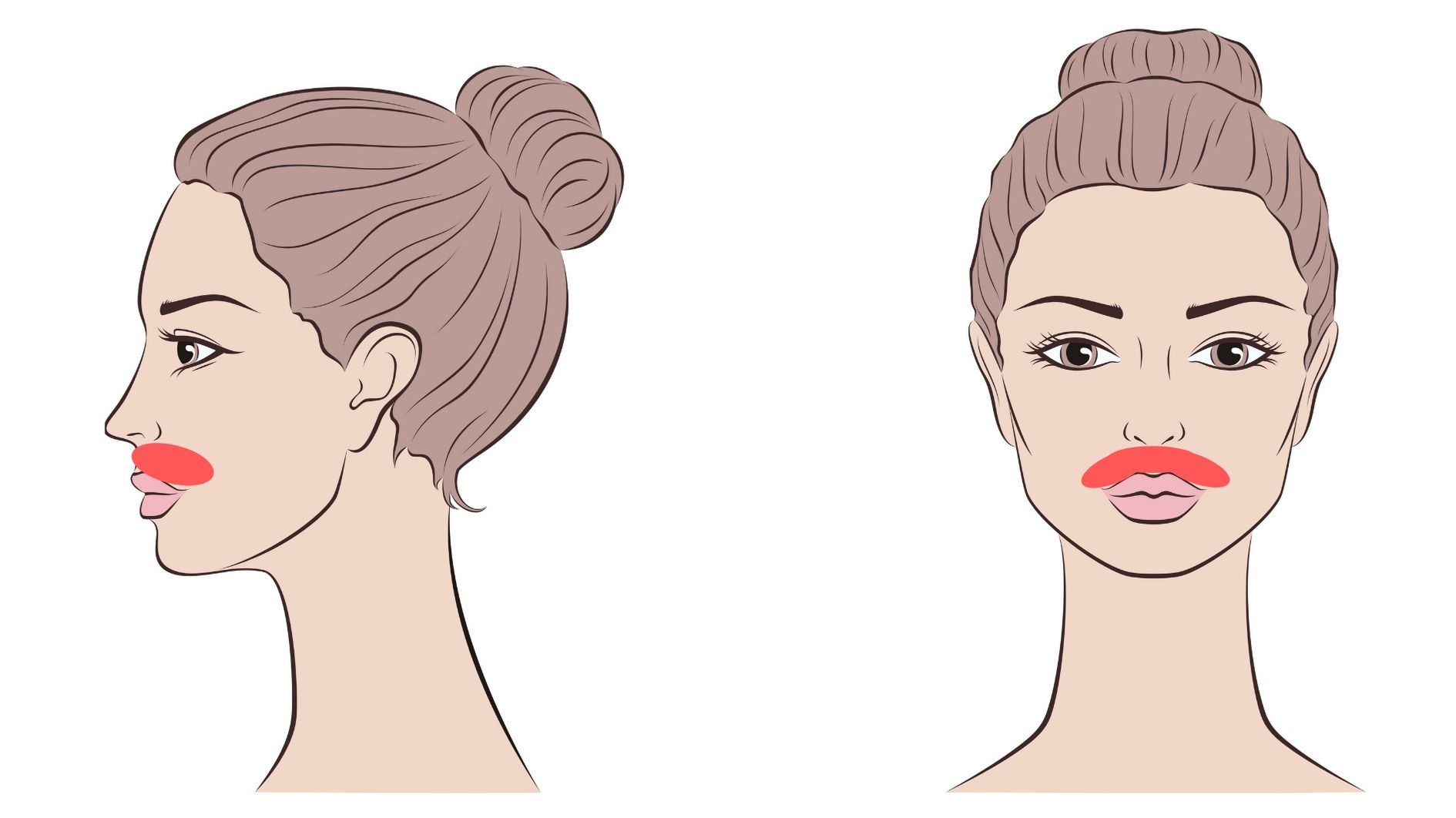facial laser hair removal upper lip treatment area