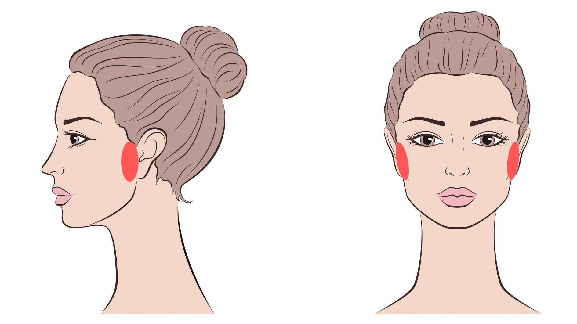 facial laser hair removal sideburns treatment area