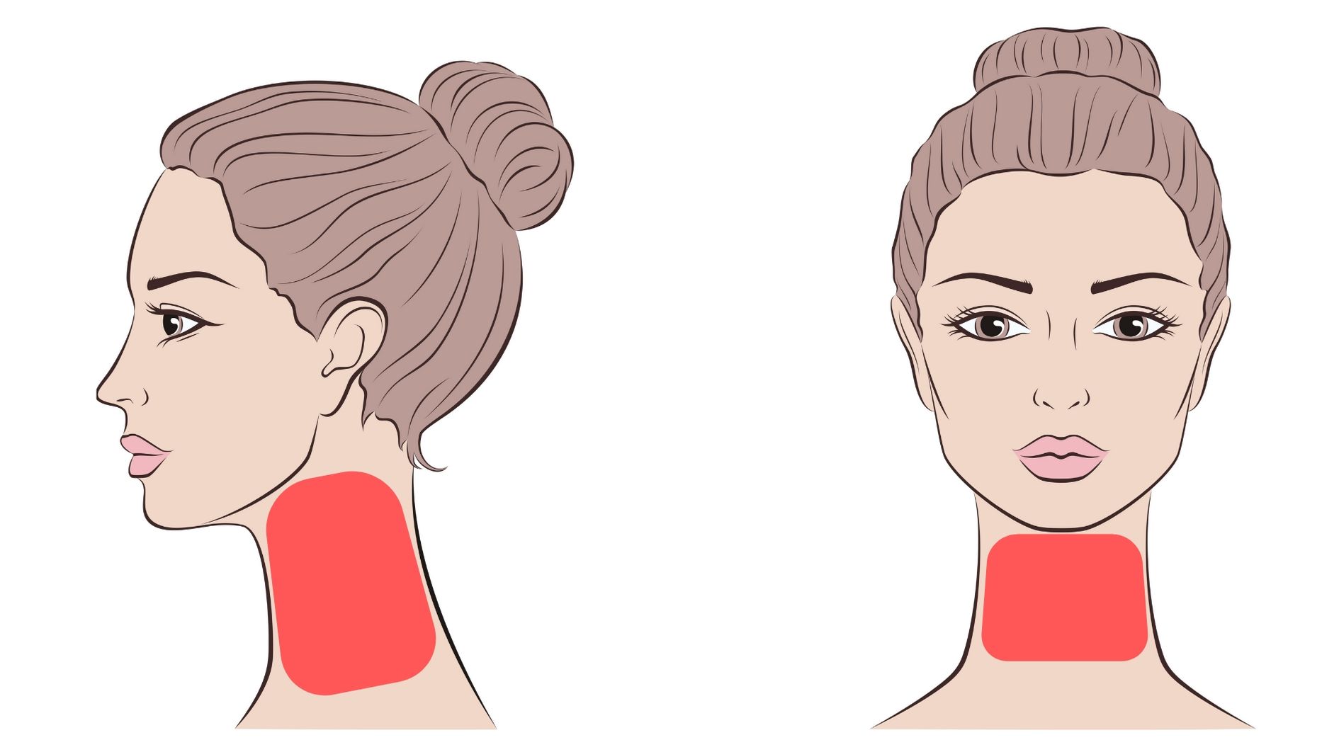 facial laser hair removal neck treatment area