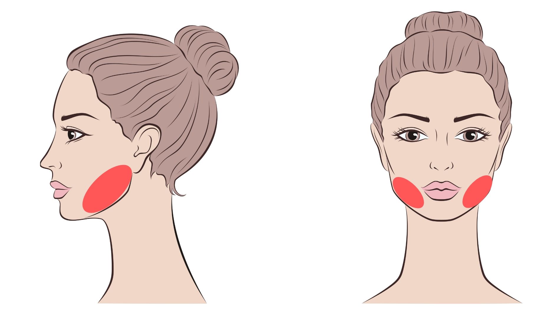 facial laser hair removal jawline treatment area