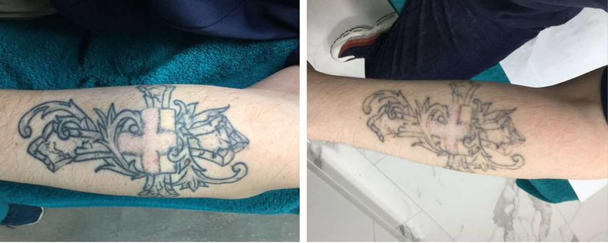 Why Tattoos Render Your Apple Watch Useless & What You Can Do To Fix it