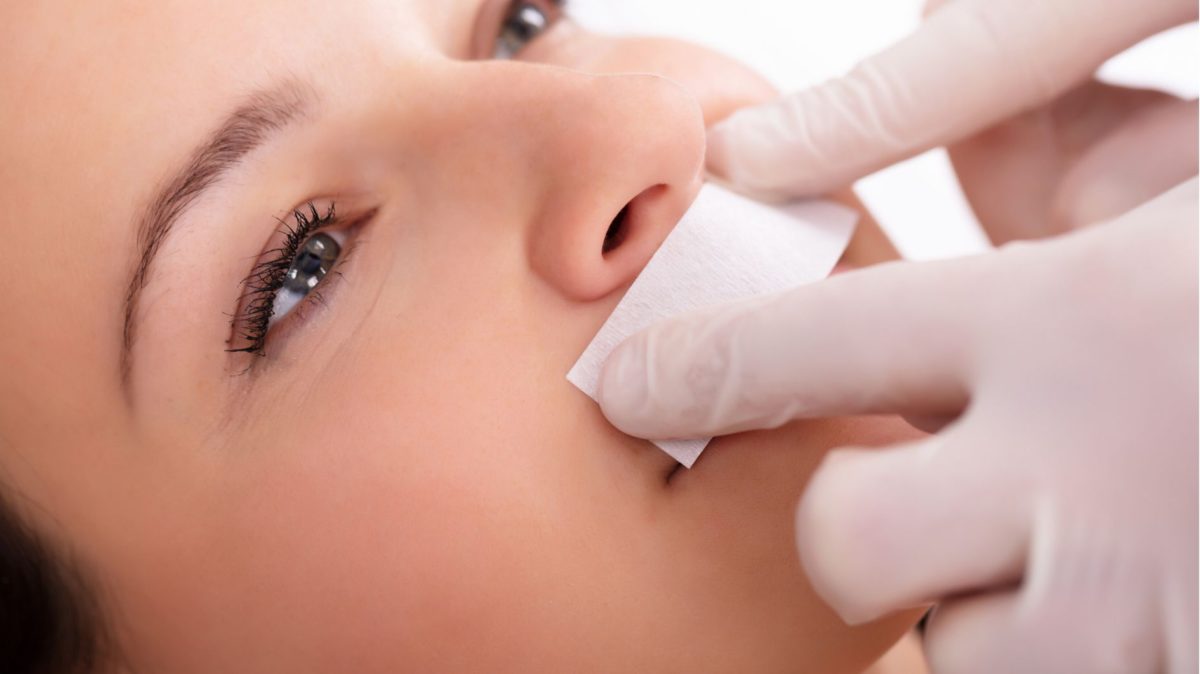 Facial Laser Hair Removal – Ultimate Guide